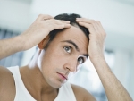 Przeszczep włosów, skuteczny sposób na wypadanie włosów