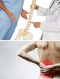 Leczenie bólów kręgosłupa